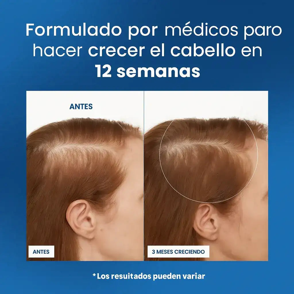 BODYWISE Roll-On de Crecimiento Capilar
