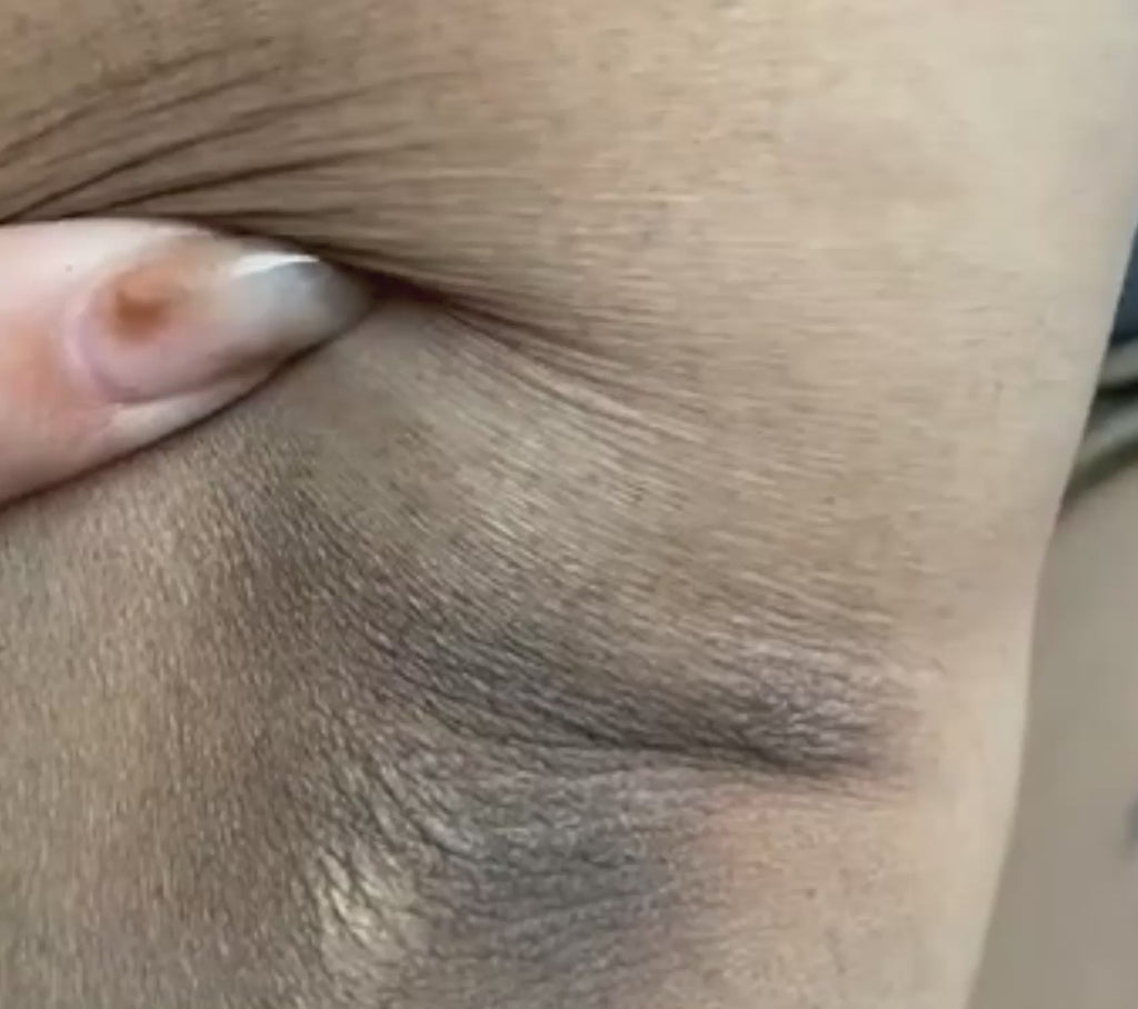 Dr. Melaxin Peel Shot™ Exfoliante Corporal Kojic + Turmeric